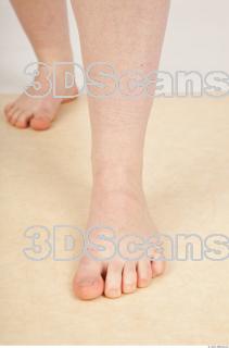 Photo reference of foot 0003